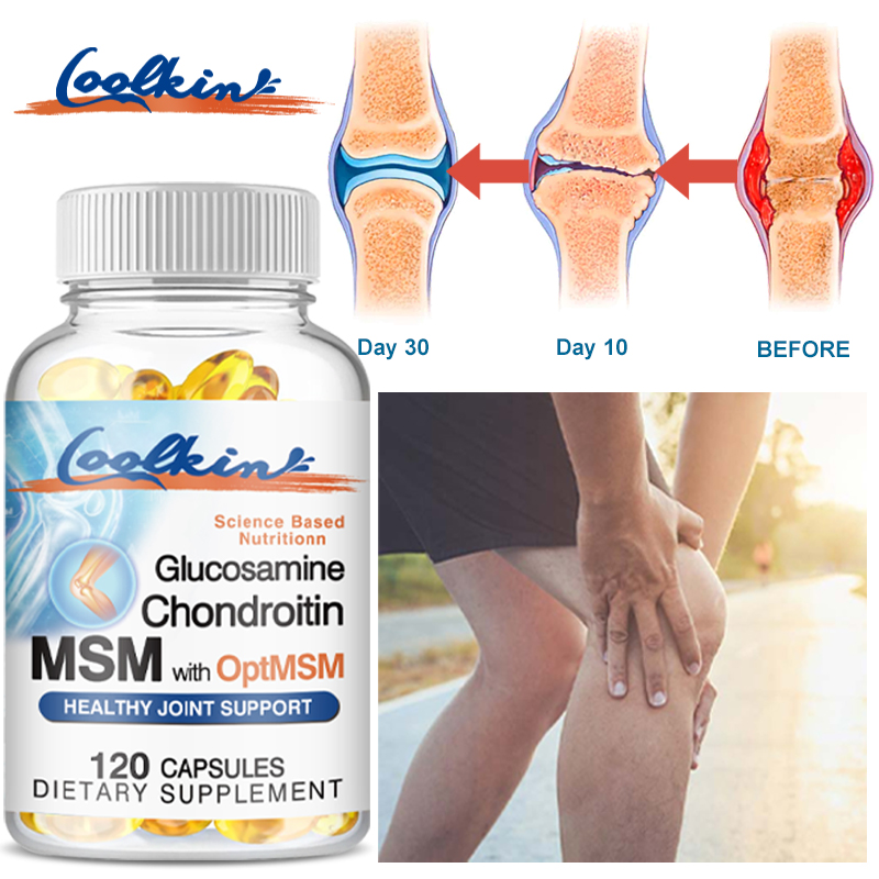 Glucosamina, Condroitina y MSM - Glucosamine Chondroitin Joint reseña y precio